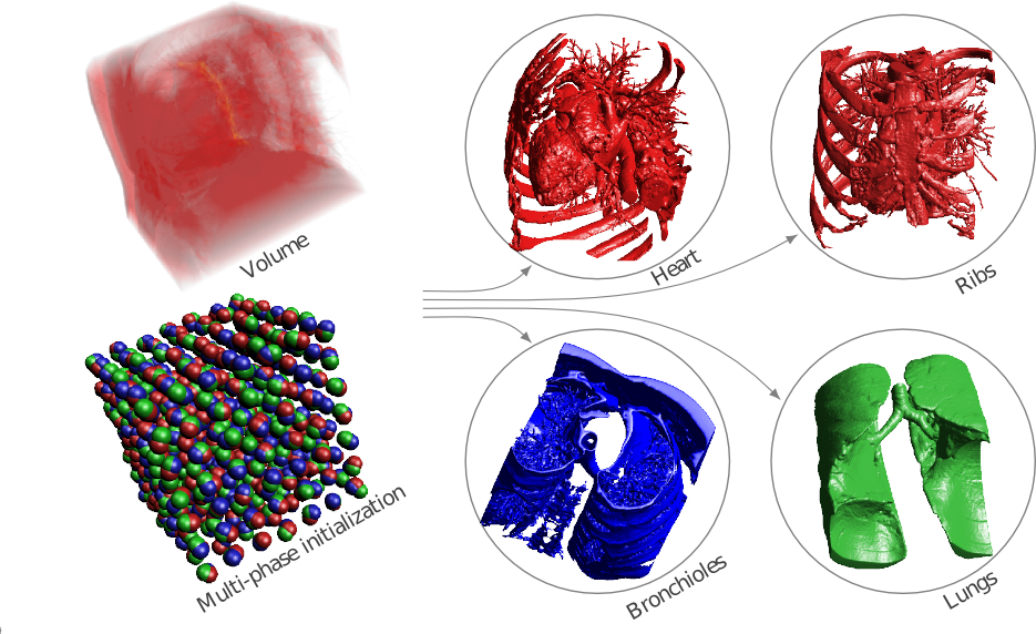 Level-set based segmentation on GPU - Graphics Research Group